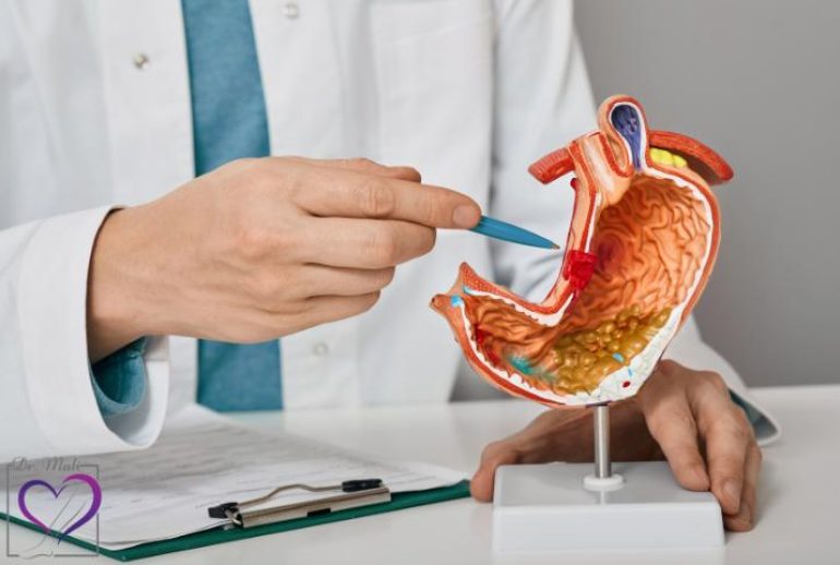 دکتر واریس معده - مشهد