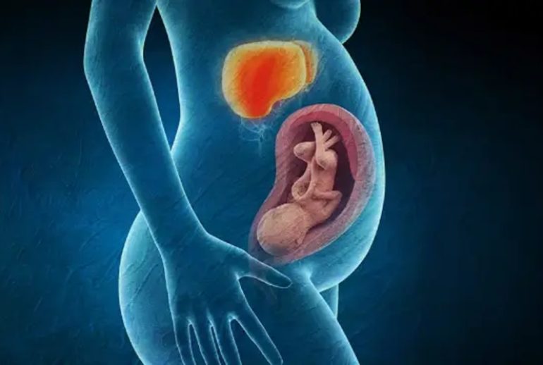 دکتر کبد چرب در بارداری - بندرعباس